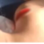 Dua Remaja Nyaris Tewas Usai Dibacok  OTK, Polisi Terus  Lakukan Pengejaran